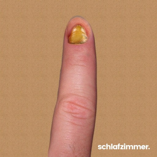 Gelbe Fingernägel