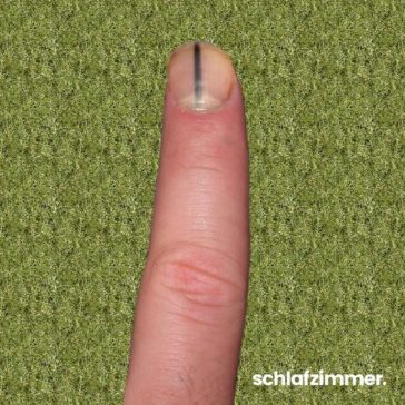 Diese 8 Fingernagel Krankheiten musst du unbedingt beachten