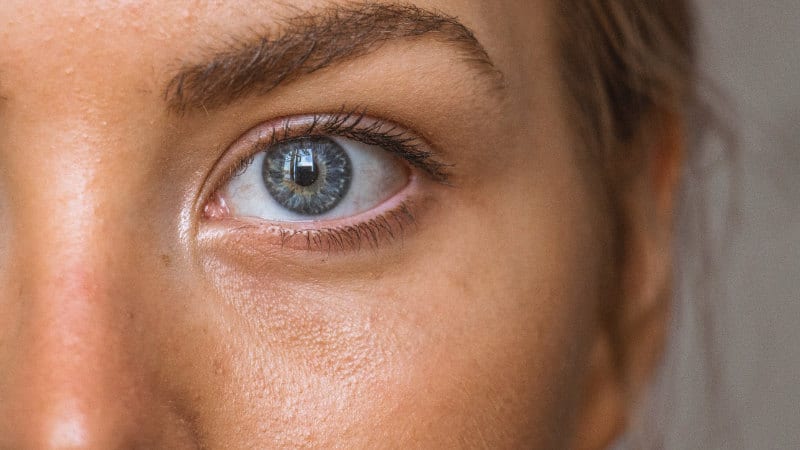 Durch den Sauerstoff bekommen die Mitesser erst die Farbe, bekannt sind Schwarz, Weiß oder Gelb