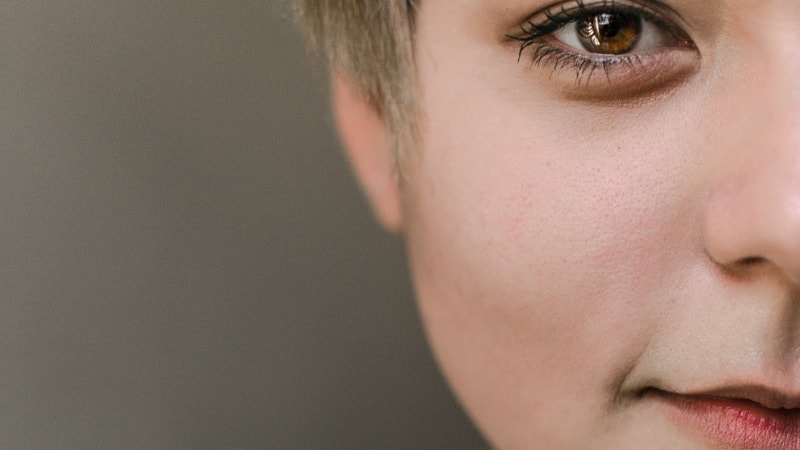 Und wieder ein guter Grund mit dem Rauchen aufzuhören. Rauchen macht nicht nur deine Haut älter, sonder verursacht Pickel