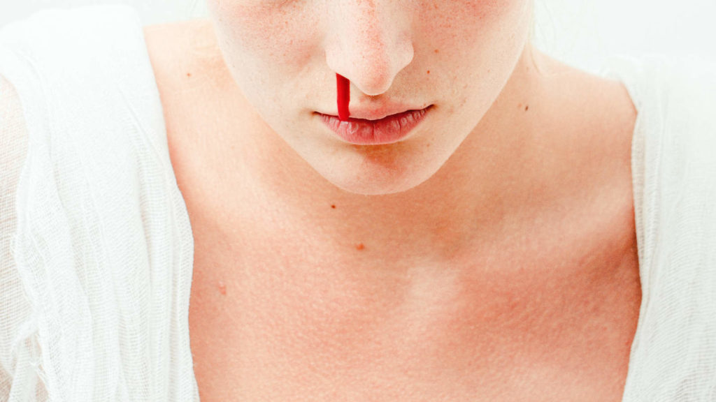 Nasenbluten stoppen: 13 Tipps zum Stoppen von Nasenbluten