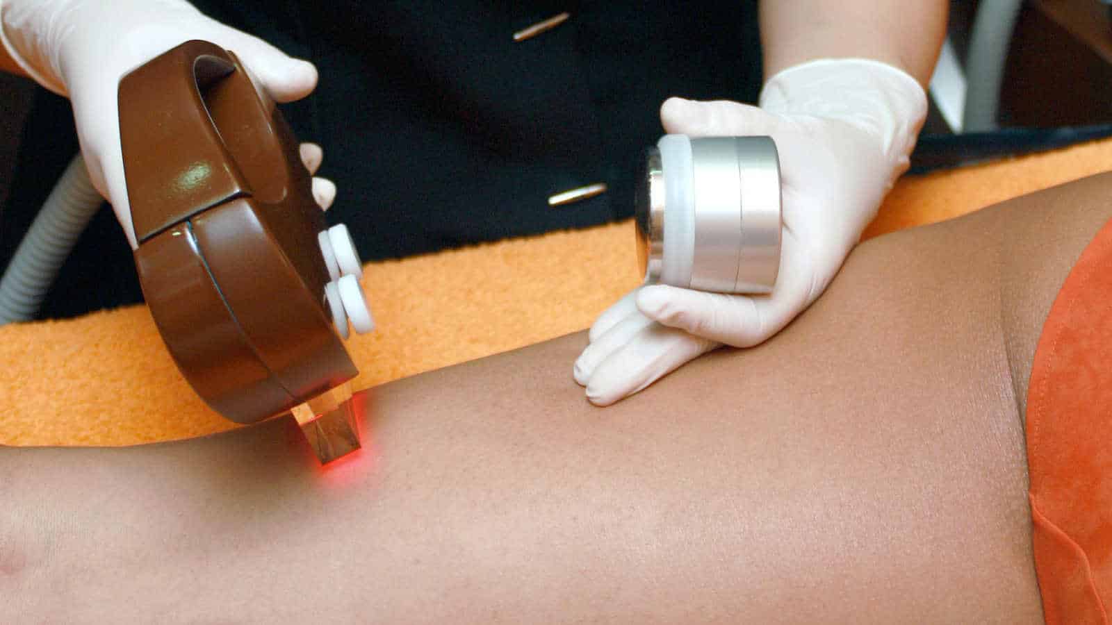 Laser-Haarentfernung ist in der Regel sicher.