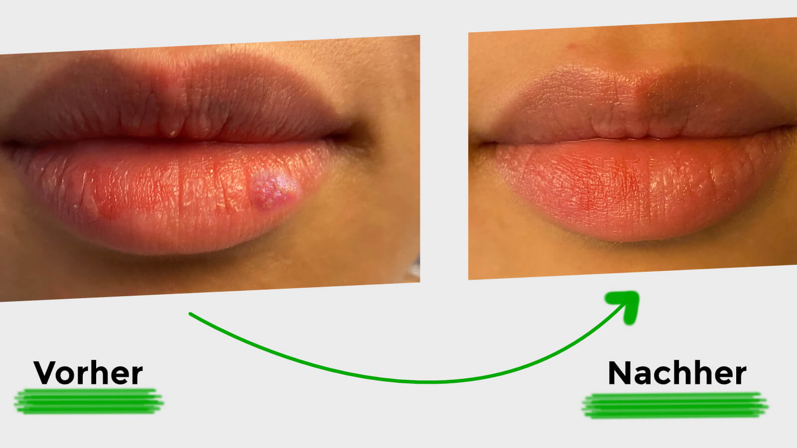 Vorher und nachher Bilder von ilon